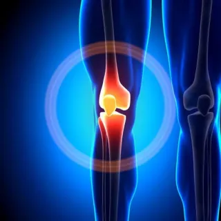 Cracking the Code of Knee Pain.  Part 2: Relief Solutions