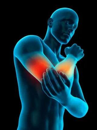 The Ultimate Guide to Tennis Elbow: Causes, Symptoms, and How to Treat Tennis Elbow at Home