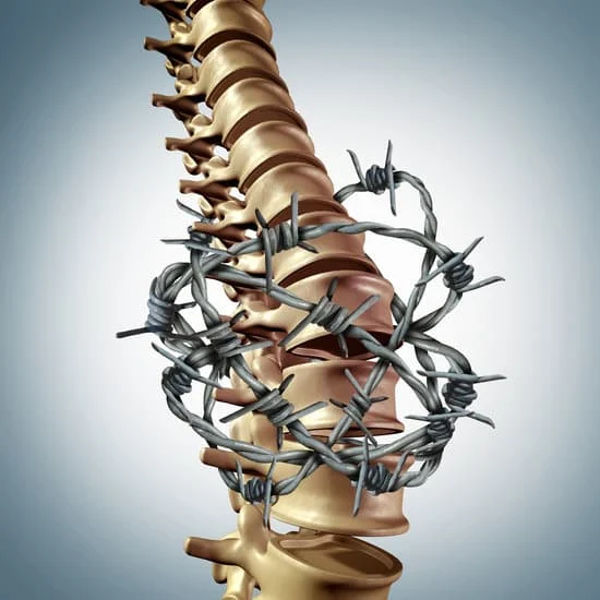 Can You Successfully Treat Spinal Stenosis Without Surgery?