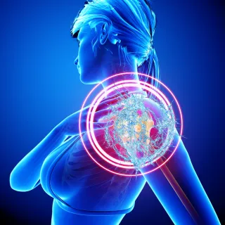Frozen Shoulder: A Comprehensive Guide to Understanding and Treatment