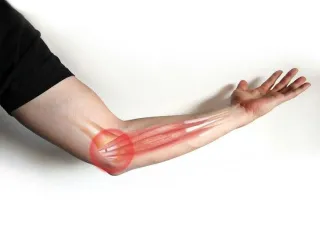 Golfers Elbow Exercises: Strengthening Your Way to a Pain-Free Swing