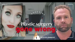Shocking Plastic Surgery Gone Wrong: