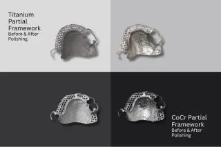 Plasma Polishing vs. Hand Finishing: The Key to Unlocking Next-Level Dental Lab Efficiency