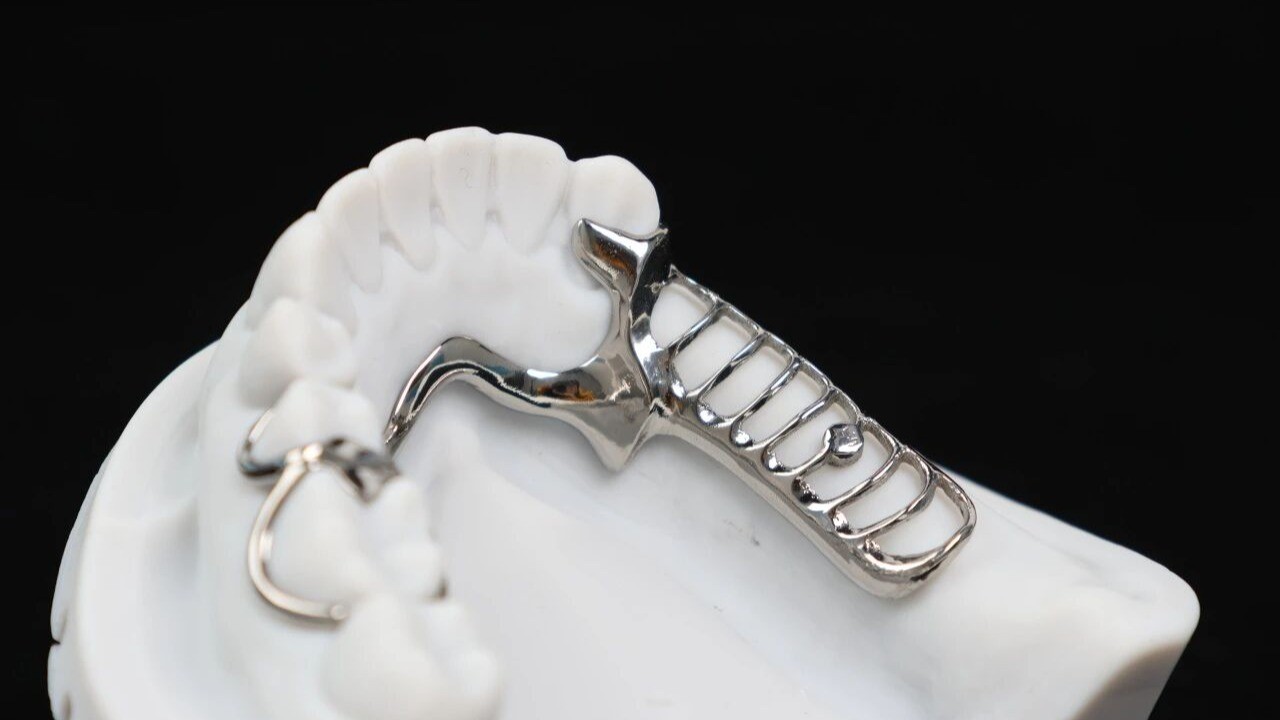 When Strength Weighs Just 2 Grams: The New Era of Titanium Denture Frameworks
