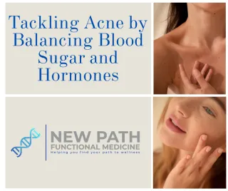 Tackling Acne by Balancing Blood Sugar and Hormones