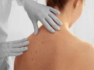 Skin Exams and Pathology: Protecting Your Skin in Vero Beach