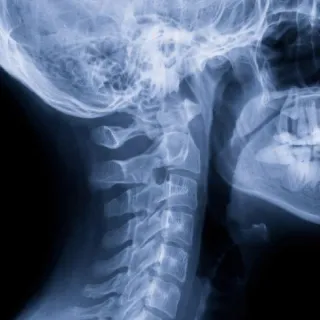 The Revolution of Digital X-Rays