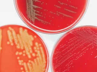 Protecting Your Family From E coli The Danolyte Fruit Veggie Wash Solution