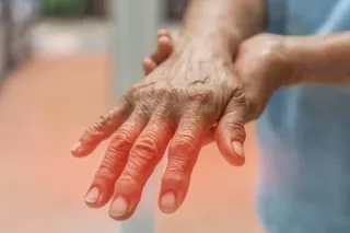 Tingling, Numbness, or Burning? It Might Be More Than Just Fatigue