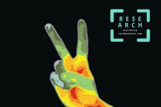 Thermography as a Breast Cancer Screening Technique