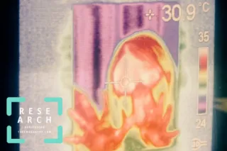 Skin Cancer Detection Using Infrared Thermography