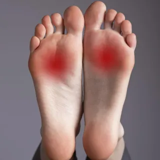 Mortons Neuroma