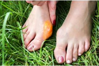 Common Foot Problems Treated by Podiatrists: From Corns and Calluses to Neuromas