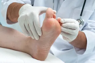 Preventing Athlete’s Foot: Tips for Athletes and Active Individuals