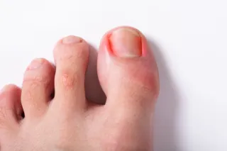 Is It Just a Sore Toe or Something More? When to See a Chiropodist