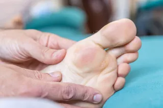 Blisters Be Gone: Prevention and Podiatrist Tips for Pain-Free Walking
