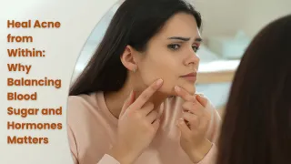 Clearer Skin Starts Within: How Blood Sugar and Hormone Balance Can Help Tackle Acne