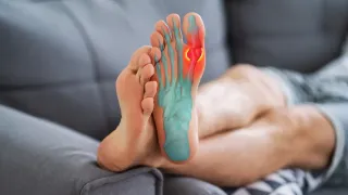 Is it better to stay off your feet with PLANTAR FASCIITIS?