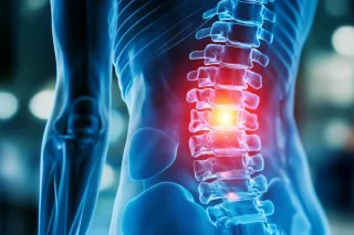 Herniated Disc: Not a Disc Disease, but a Result of Muscular Compression