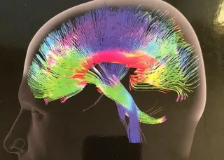 BRAIN HEALTH IS MENTAL HEALTH