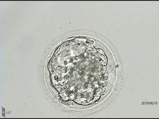 Pursuing Surrogacy with One Embryo