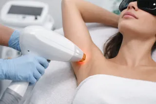 Laser Hair Removal: Everything You Need to Know