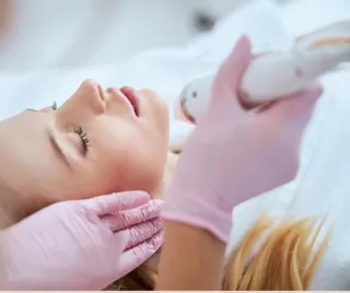 Microneedling