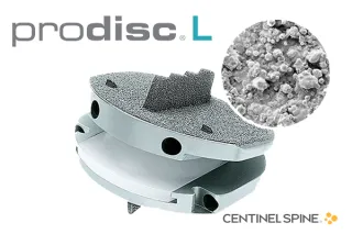 ProDisc-L-total-disc-replacement