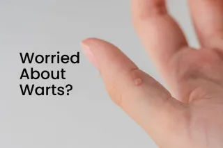 Worried About Warts?
