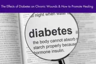 The Effects of Diabetes on Chronic Wounds & How to Promote Healing