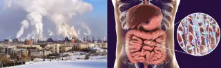 Environmental Toxins and Gut Health
