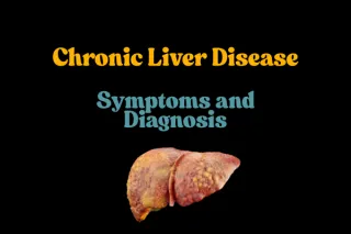 Chronic Liver Disease Testing & Diagnosis | Quick Lab Mobile Miami

