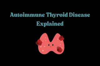 Hashimoto’s Thyroiditis: Symptoms and Causes