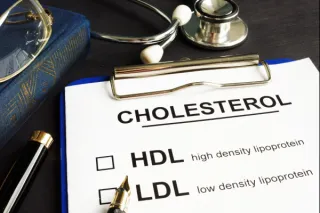 Small Dense LDL: The Hidden Risk for Heart Disease