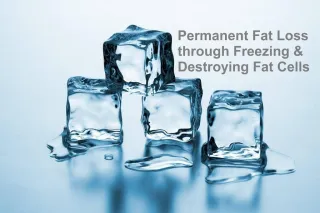 Cryoskin vs. Coolsculpting