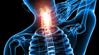 When Should You Not Ignore Neck Pain?