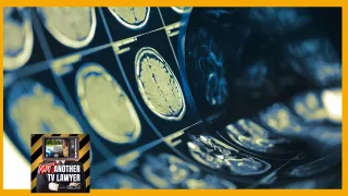 Understanding Mild Traumatic Brain Injuries