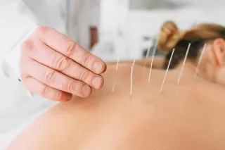 How Acupuncture Supports Pelvic Floor Health: A Holistic Approach