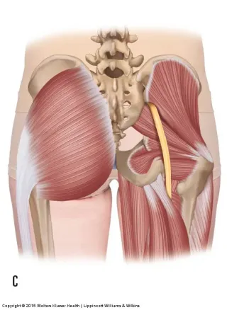 Piriformis Syndrome Pain Relief in Evansville Indiana