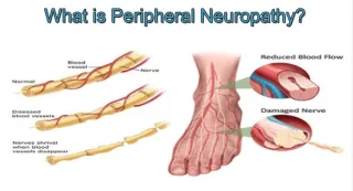 Advanced Neuropathy Relief with Chiropractic Care in Evansville, Indiana