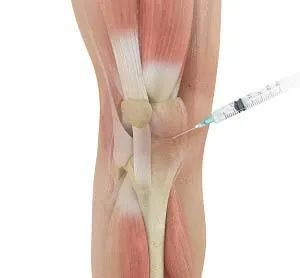 Why Corticosteroids May Be Harming Your Joints — A Safer, Natural Alternative