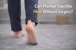 Can Plantar Fasciitis Heal Without Surgery?
