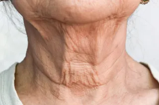 Your Neck is in Check! Tips for Aging Neck.