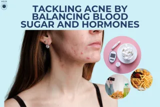 Tackling Acne by Balancing Blood Sugar and Hormones