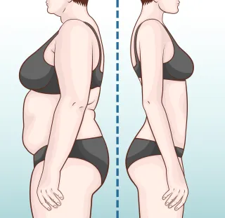 Benefits of Fat Dissolving Injections
