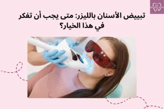 تبييض الأسنان بالليزر: متى يجب أن تفكر في هذا الخيار؟ | د. هديل عزمي