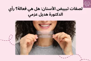 لصقات تبييض الأسنان: هل هي فعالة؟ | د. هديل عزمي
