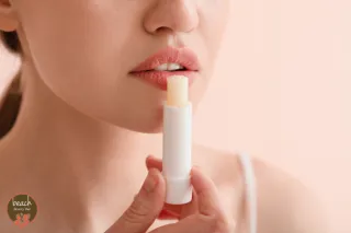 Lip Balms and Acne