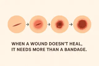 What Are Chronic Wounds and Why Don’t They Heal?