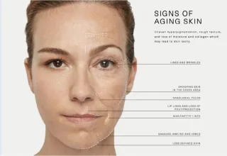 Facial Aging